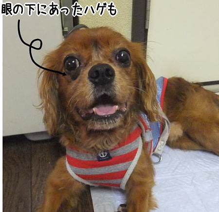 目の下のハゲ